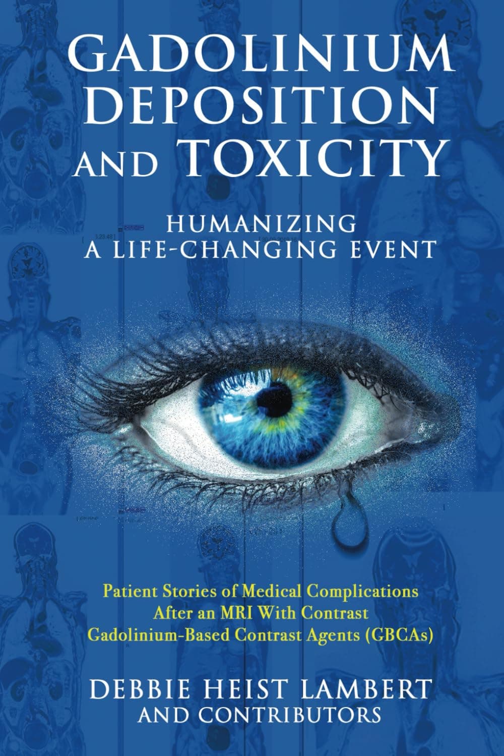 Gadolinium Deposition and Toxicity: Humanizing a Life-Changing Event by Debbie Heist Lambert